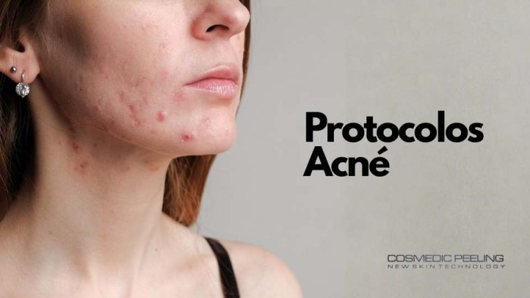Protocolos Profesionales para el Tratamiento del Acné